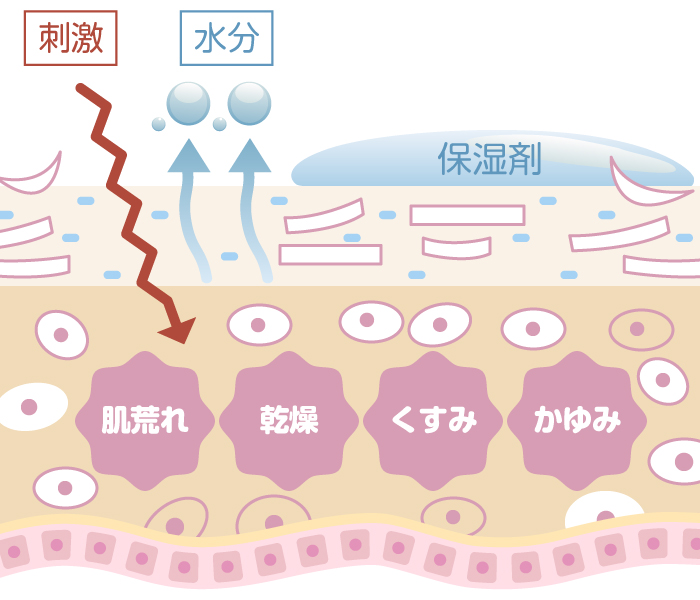 保湿剤ではターンオーバーの質が改善しないことを示す肌図