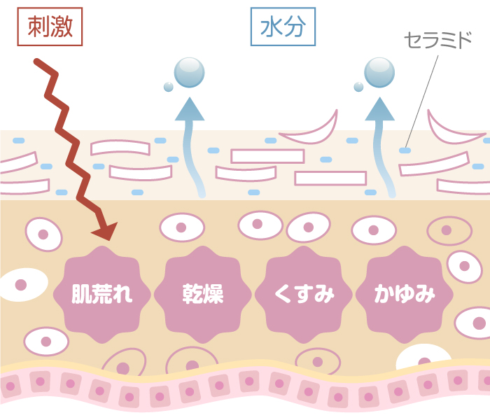 バリア機能が壊れている肌図